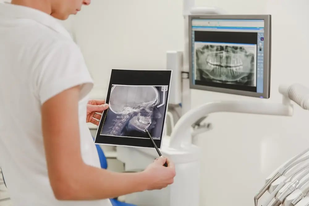 Avaliação clínica com exames imagiológicos para planear o número de implantes de uma overdenture.