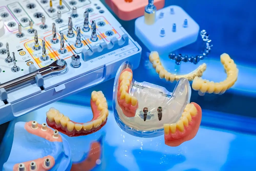 Materiais e componentes dentro do preço, utilizados em tratamentos com implantes dentários.