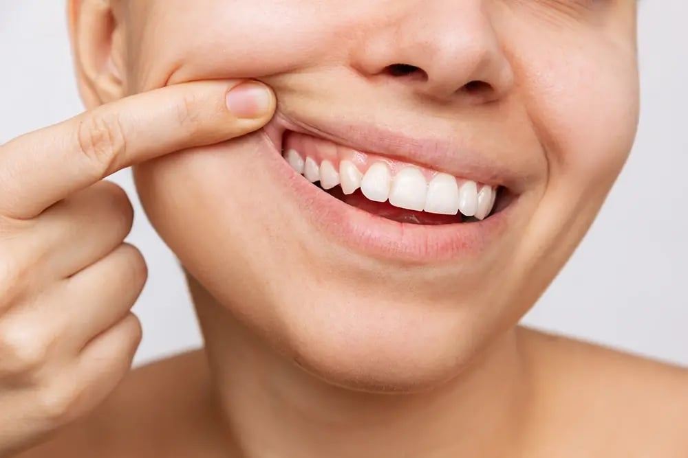 Pessoa a mostrar uma gengiva saudável junto aos dentes naturais, ilustrando a importância da saúde gengival e da manutenção para a durabilidade dos implantes dentários.