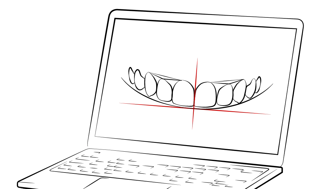 Prótese Fixa em 24h OralPlan