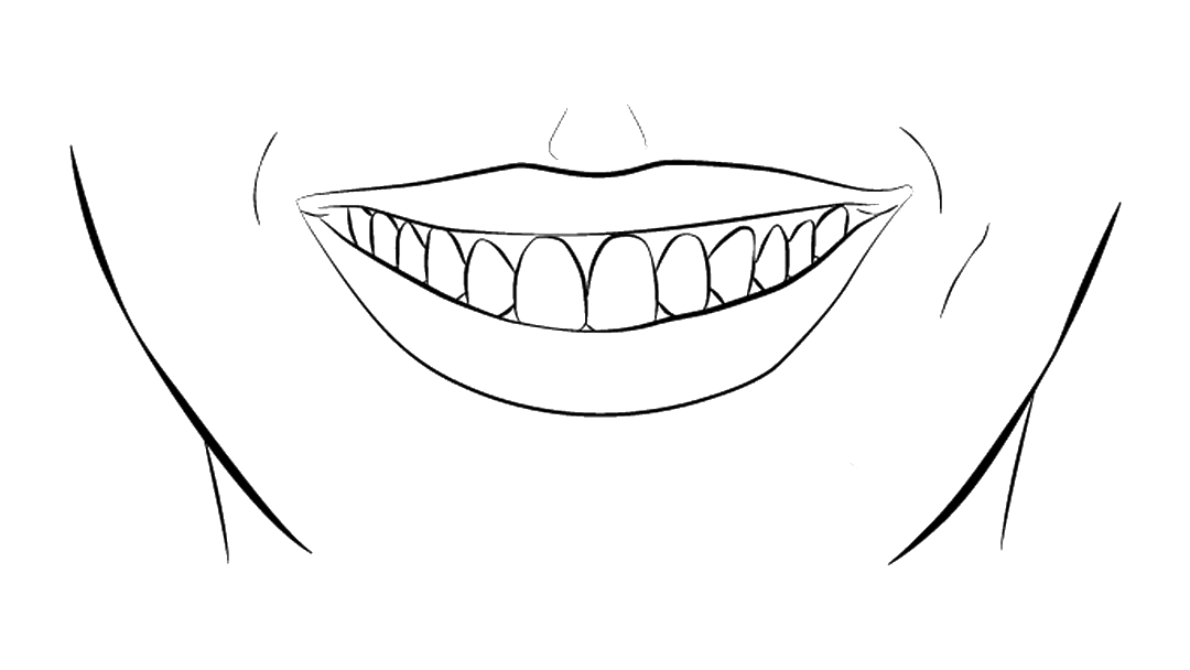 Prótese Fixa em 24h OralPlan