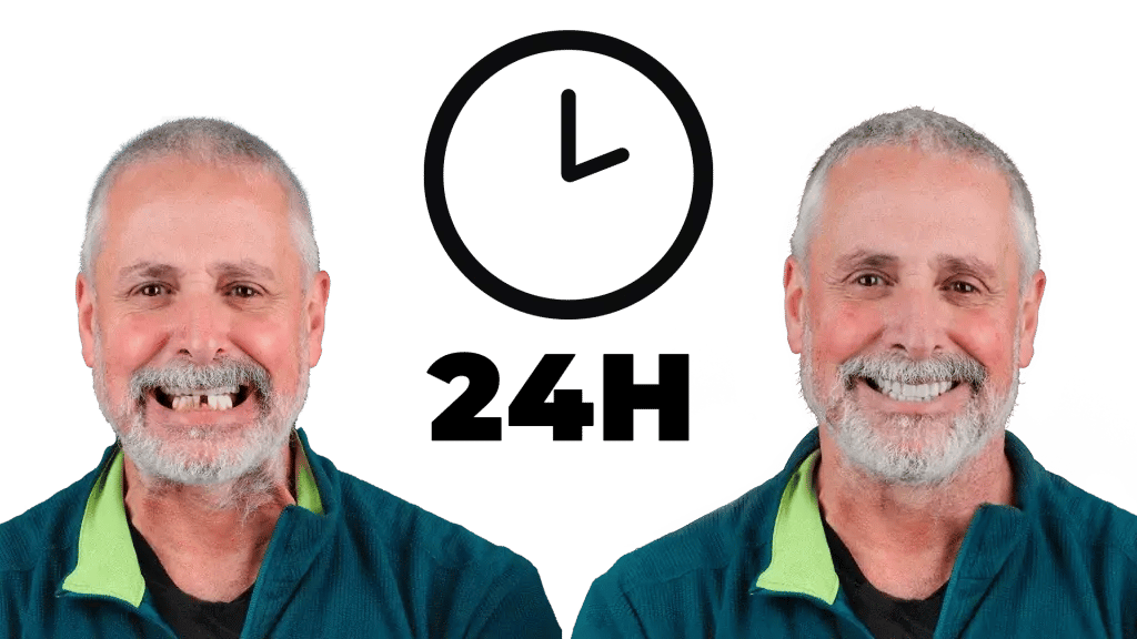 Prótese Fixa em 24h OralPlan