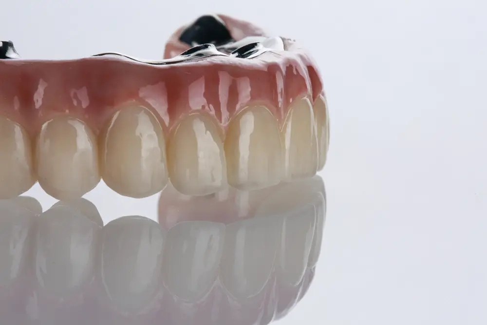 Cirurgia de implantes dentários: como conseguimos colocar dentes fixos no próprio dia