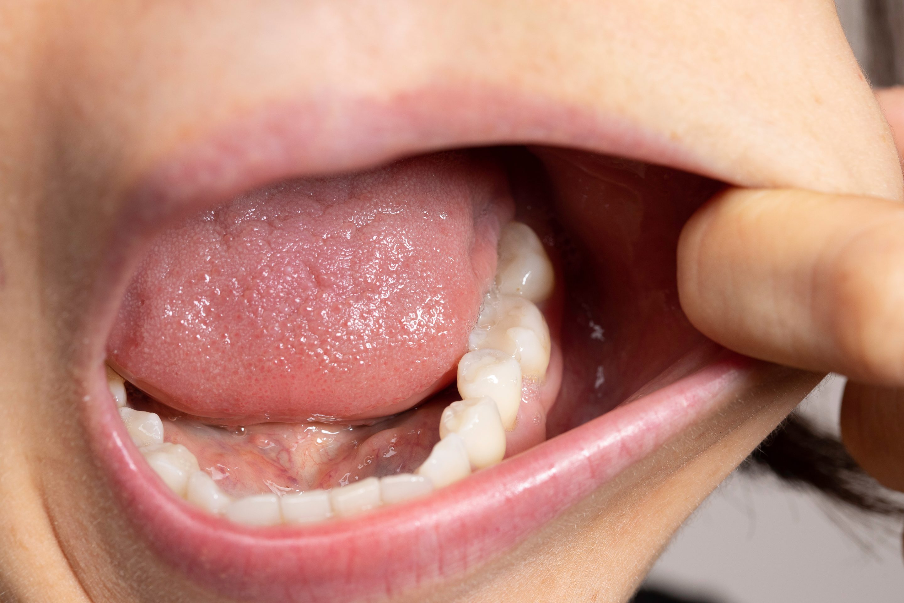 O poder da saliva: muito mais que um líquido na boca