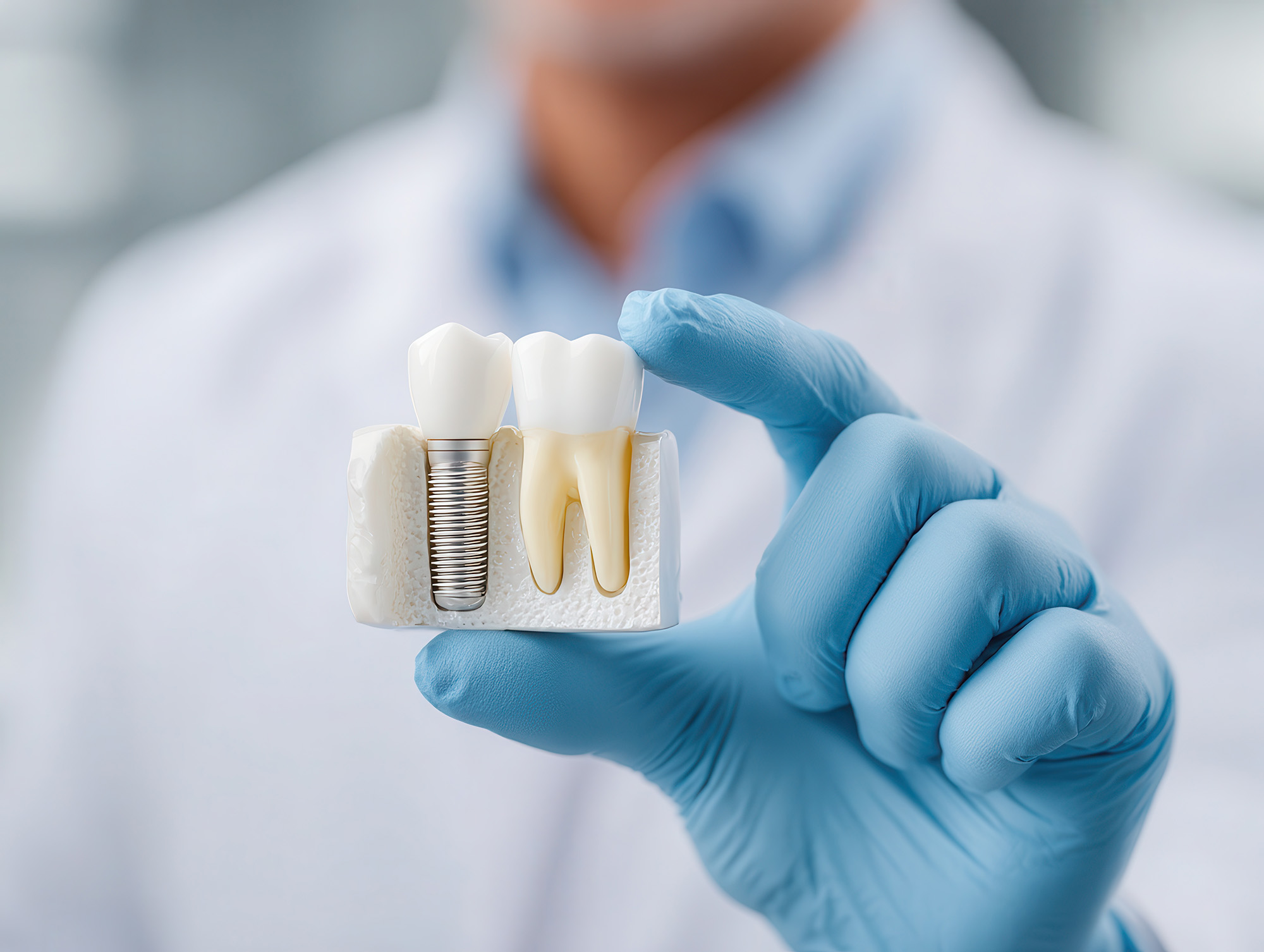 Quanto tempo demora a colocar um implante dentário?