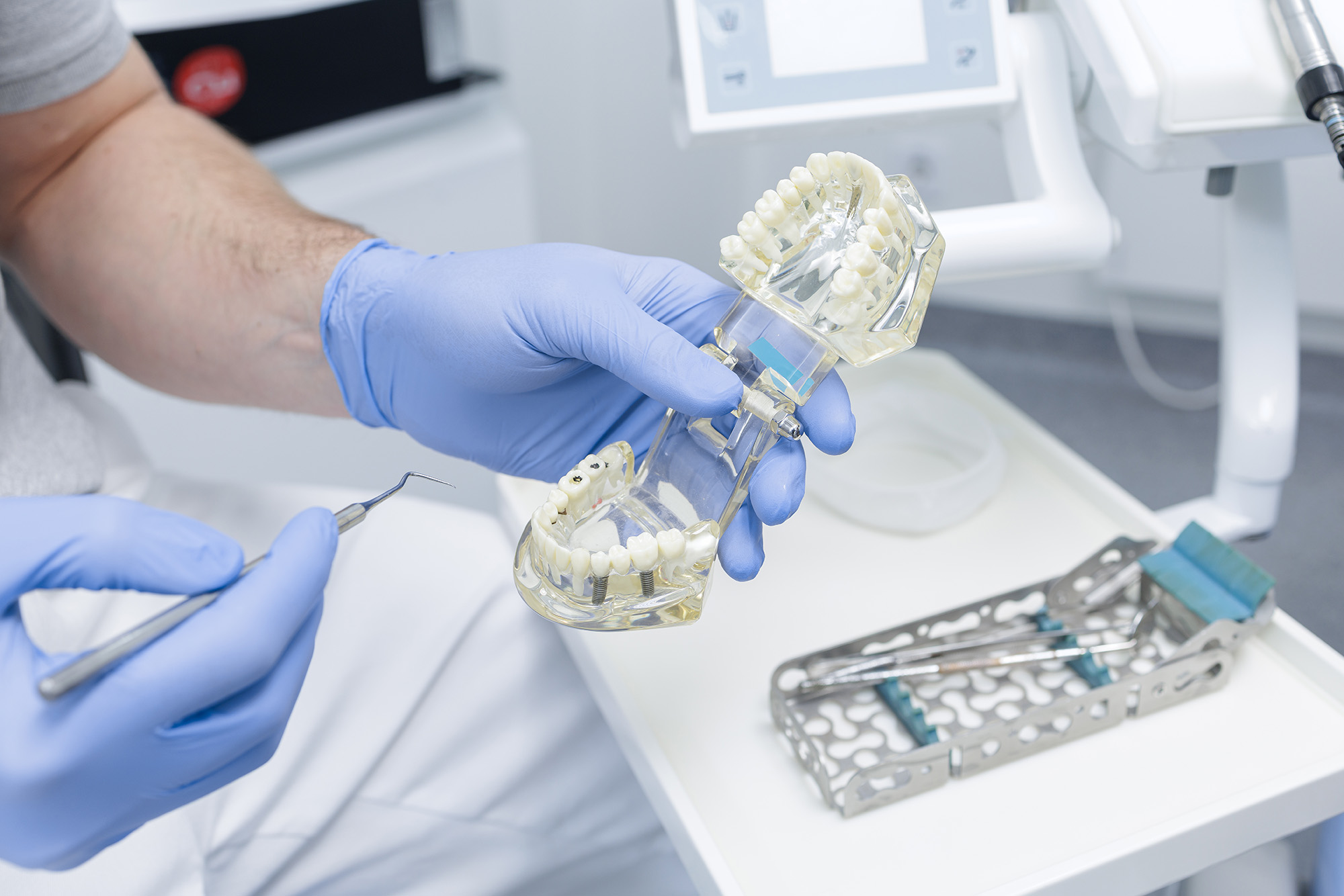 Erros mais comuns nos cuidados pós-cirurgia de implantes dentários e como evitá-los