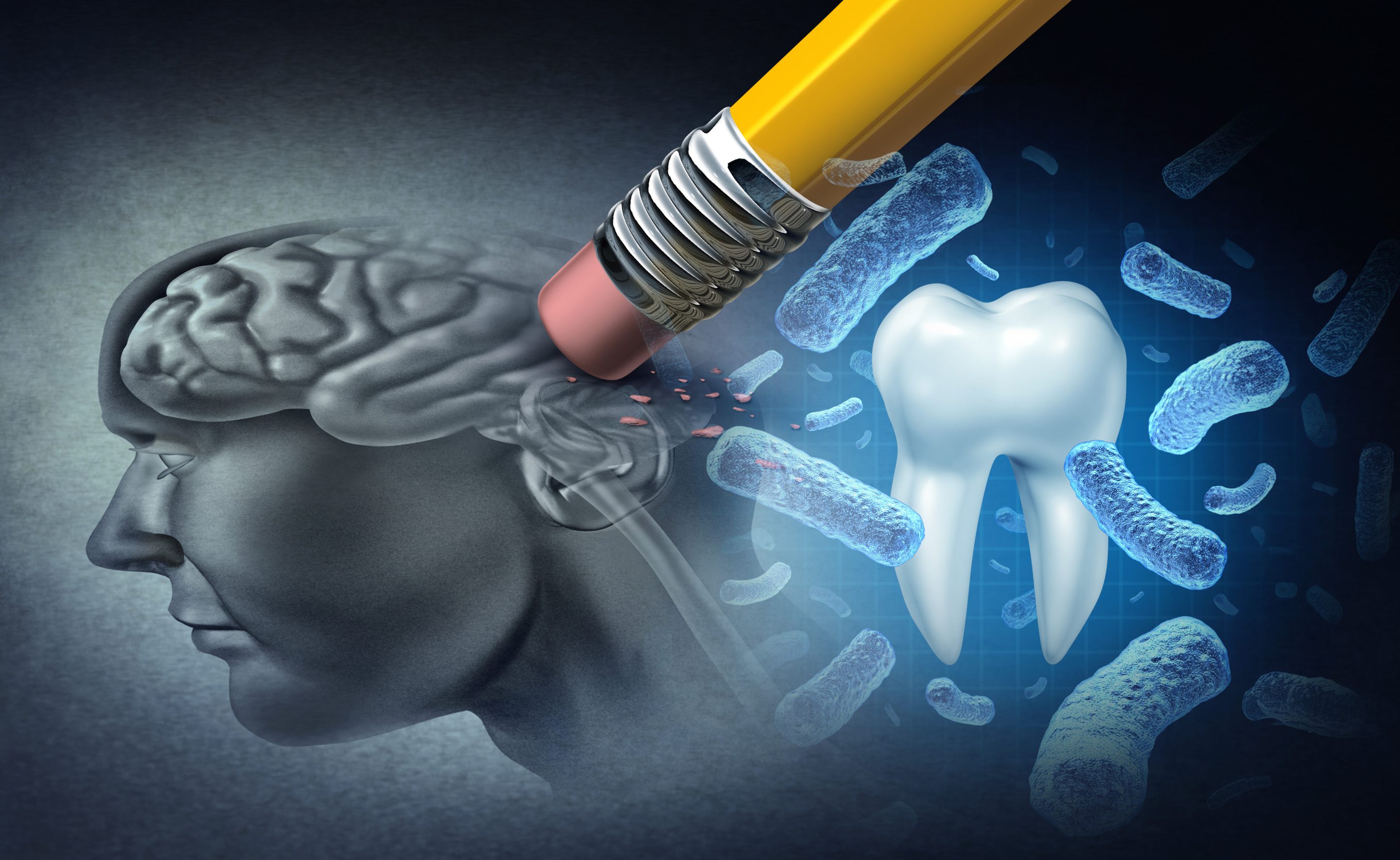 A ligação entre a doença de Alzheimer e as suas gengivas