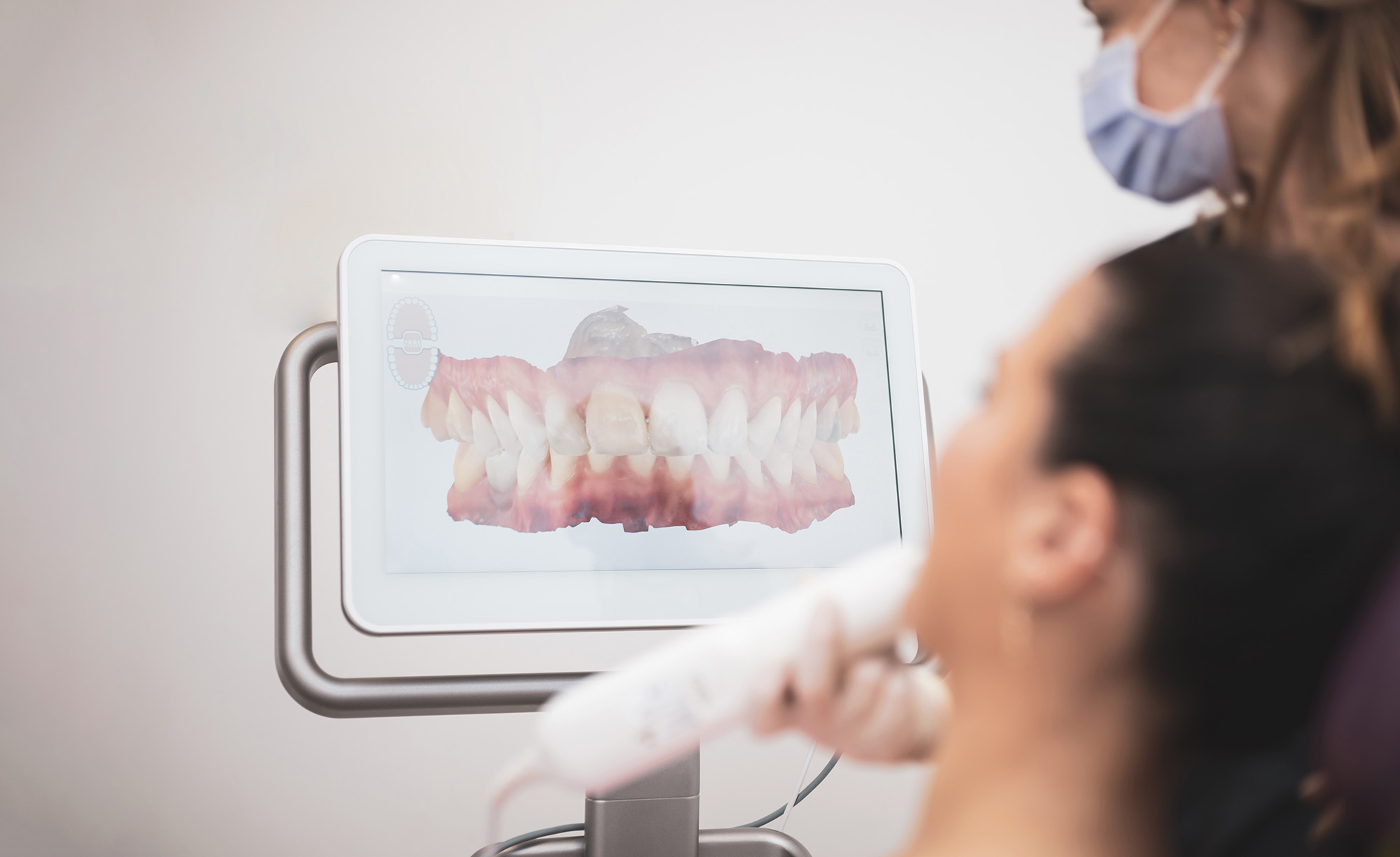Etapas de um implante dentário com planeamento digital