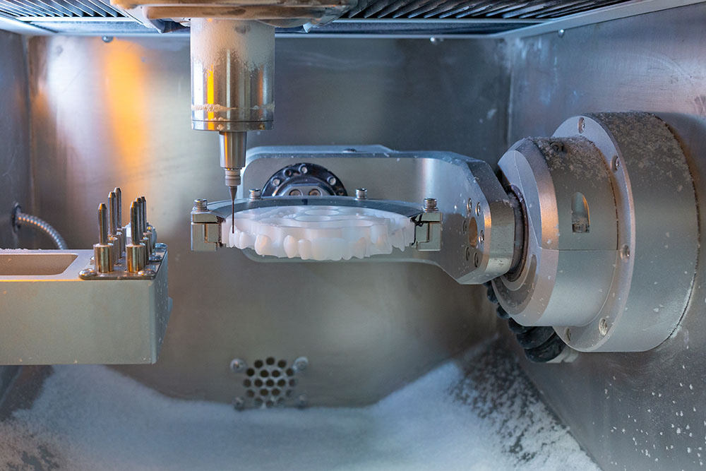 Prótese fixa com barra fresada: o que é e como funciona