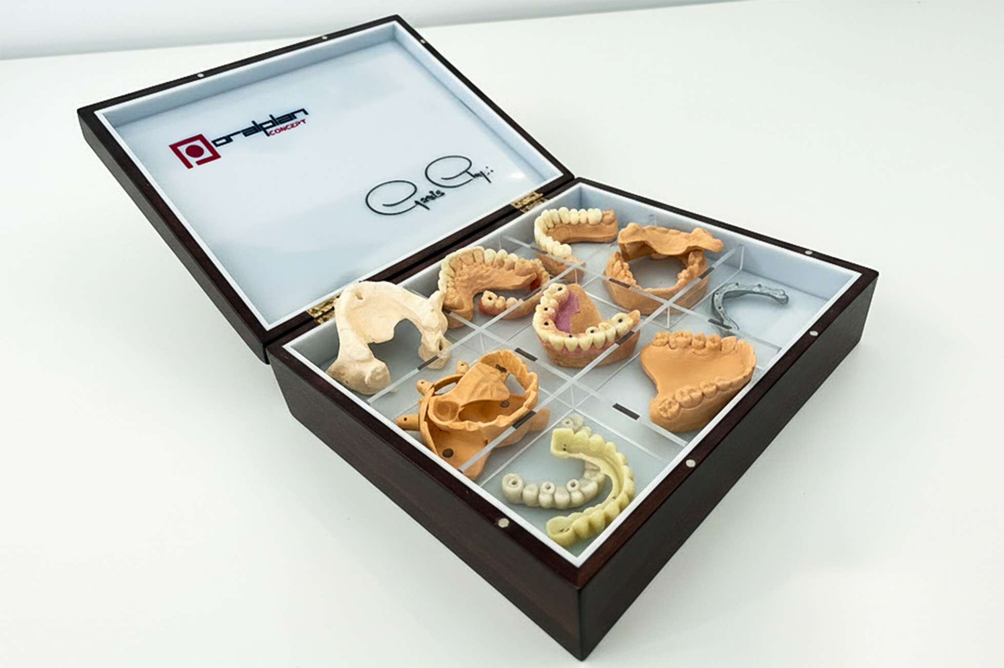 Prótese dentária fixa: o que é e que tipos existem