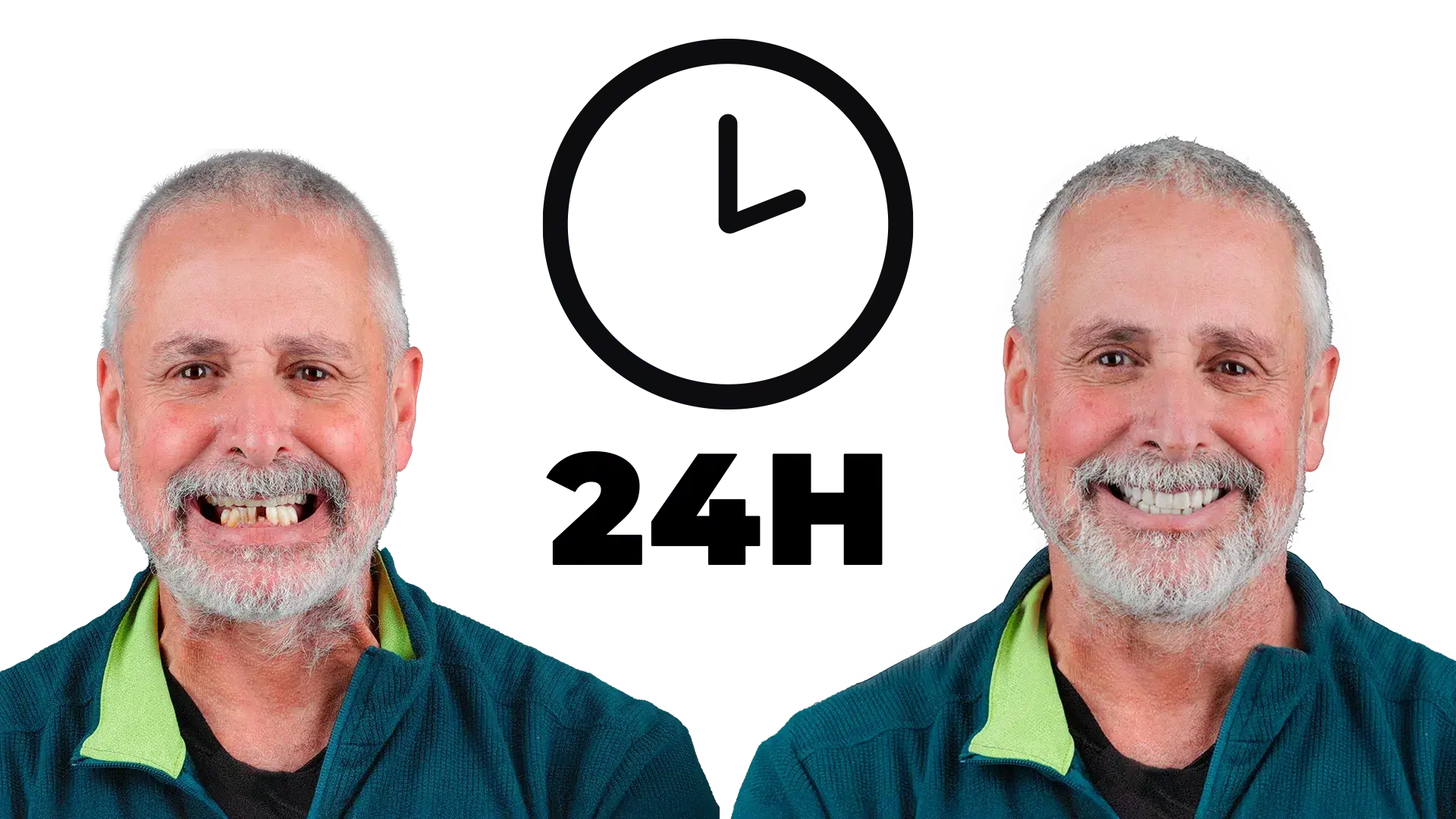 Colocação de Prótese Fixa em 24h