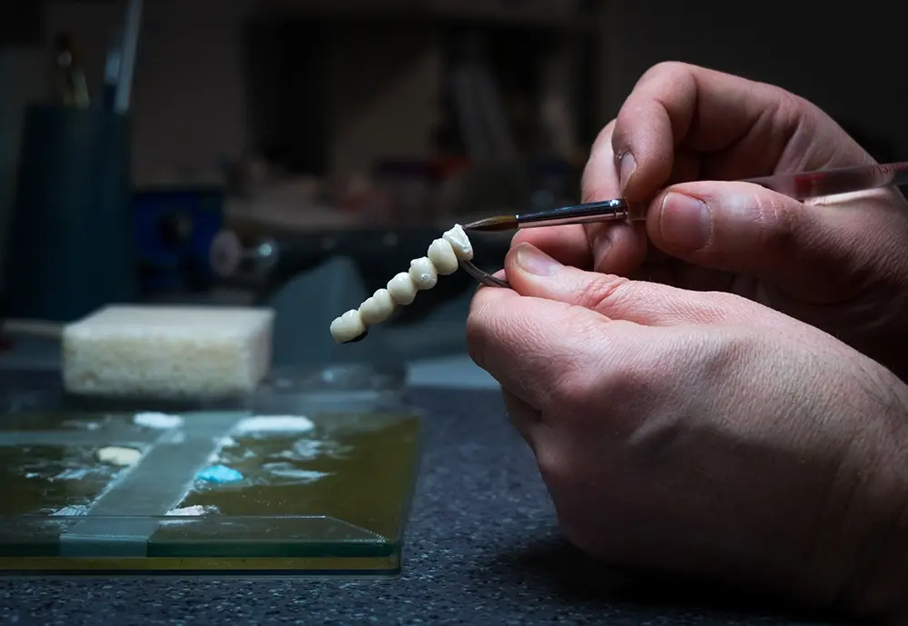 A prótese colocada na cirurgia de implantes de carga imediata é definitiva?
